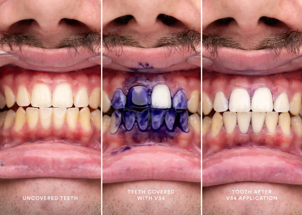 PASTA OBSESSIVE® DENTAL BLANQUEADORA