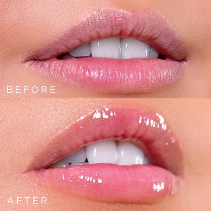 Kiss Beauty®️ Voluminizador de Labios con Brillo