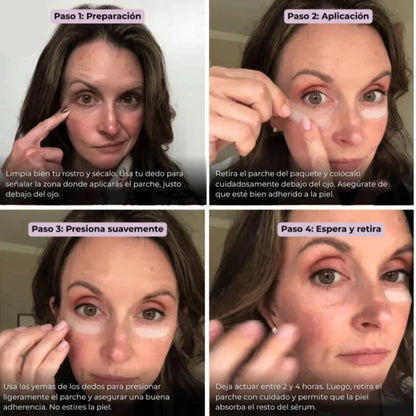 VITALGLOW® Parches de Colageno – Rejuvenece tu Mirada en 20 Minutos